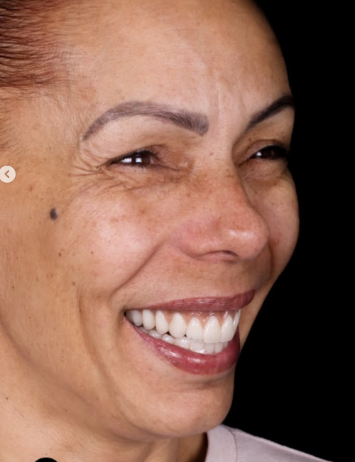 Sonrisa Después